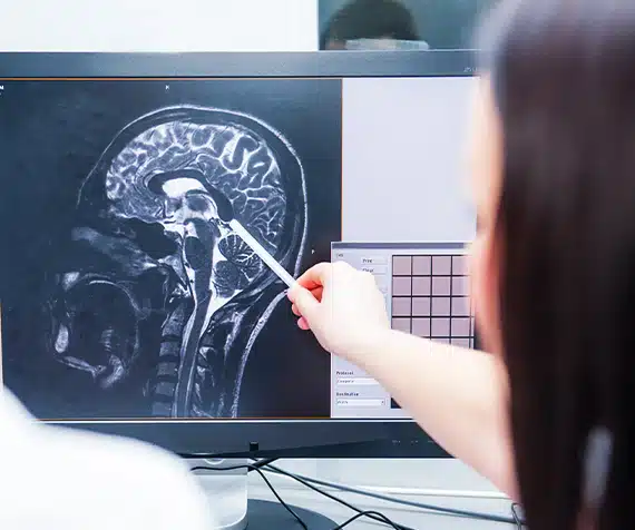 Head injury common Boston