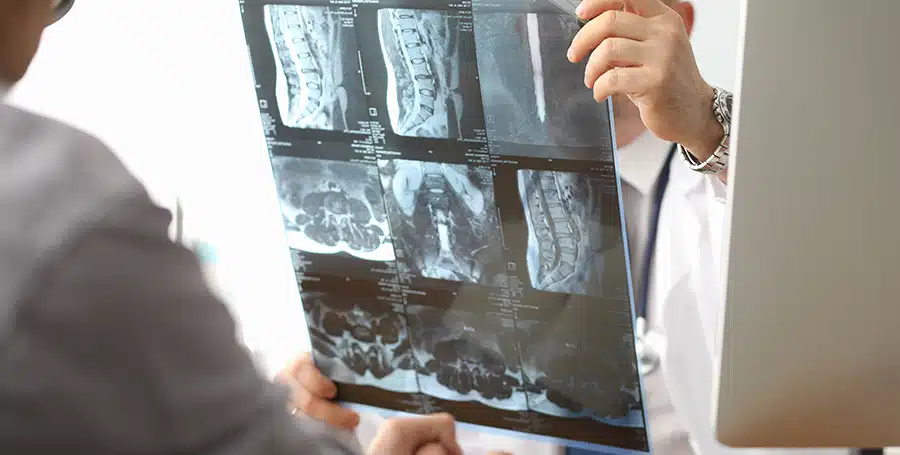 Boston Spinal Cord Injury Lawyers