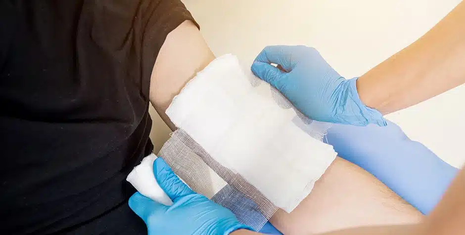 Boston Burn Injury Lawyer