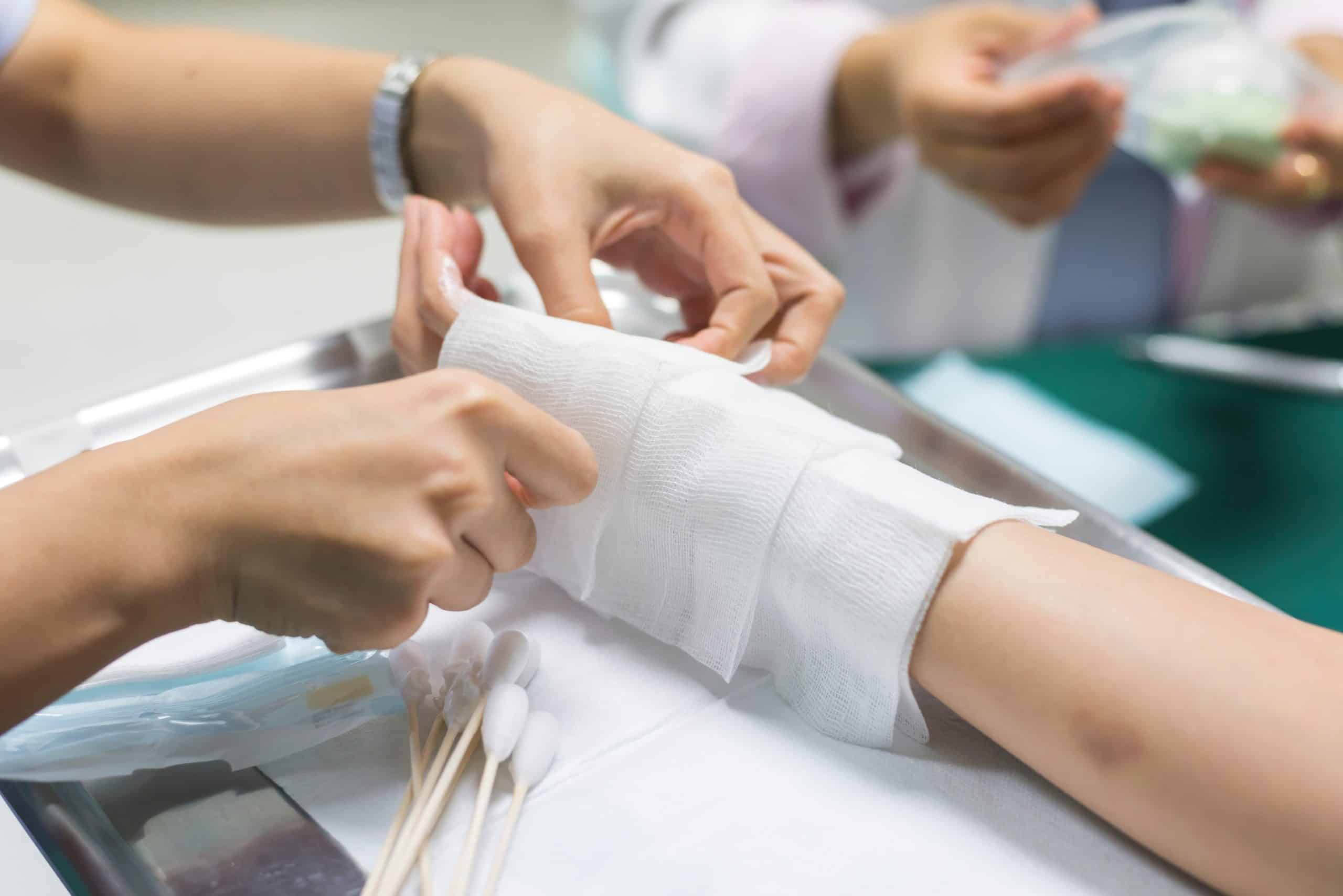 New Study Argues That Burn Injuries Are Like Chronic Diseases ...