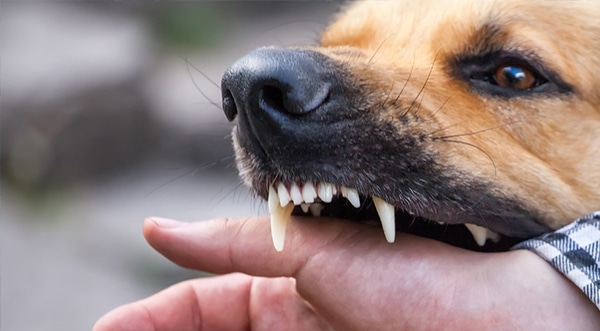 Boston Dog Bite Injury Lawyers Boston Dog Bite Injury Lawyers