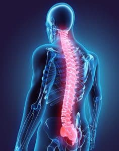 Proving Future Medical Needs in a Boston Spinal Cord Injury Case